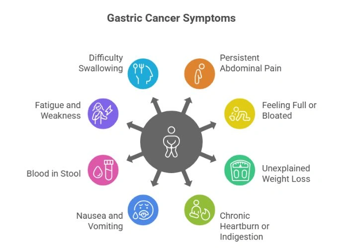 Symptoms of Gastric Cancer